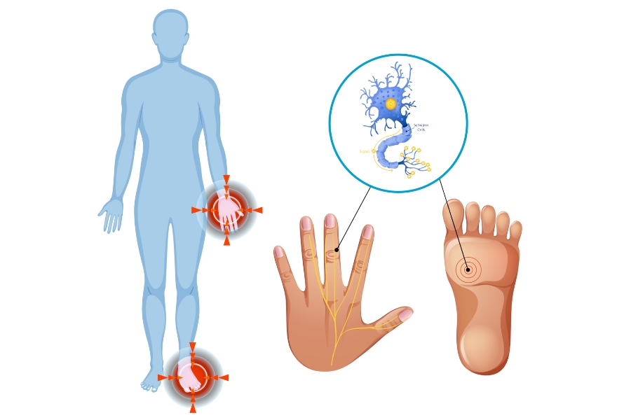 Neuromuscular Disorders-img