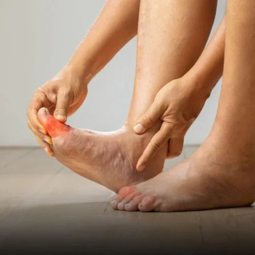 Peripheral Neuropathy -simg